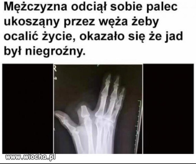 Gdy ugryzie Cię wąż...
