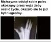 Gdy ugryzie Cię wąż...