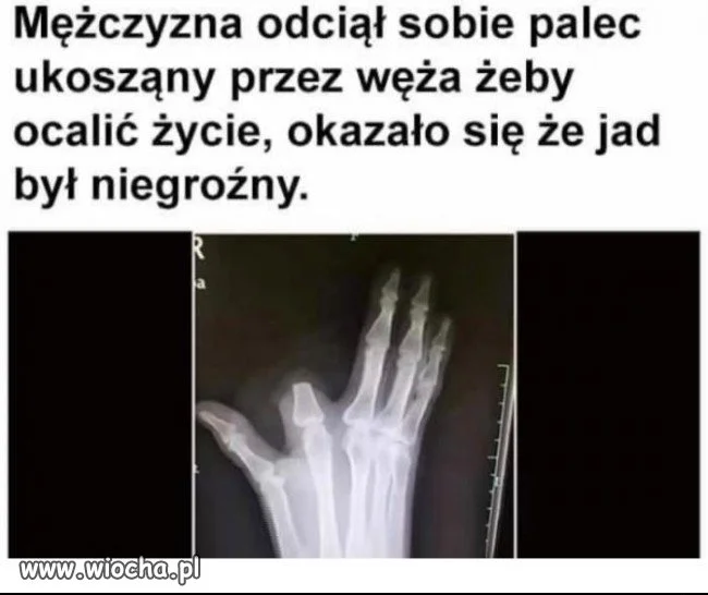 Gdy ugryzie Cię wąż...
