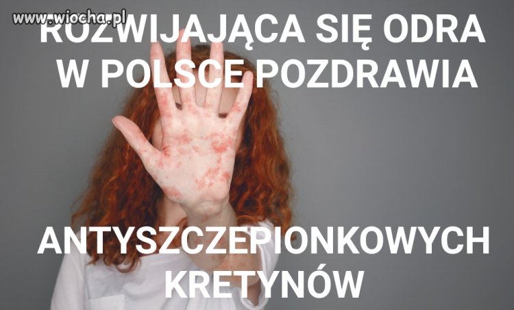 Wzrost zachorowalności i na odrę w Polsce