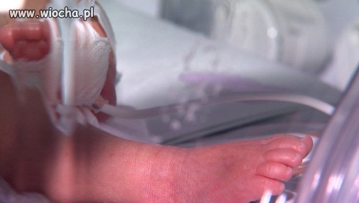 Zmarło dziecko, które urodziło się mając 