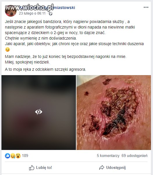 Kiedy złapie cię gastrofaza.
