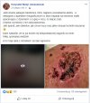 Kiedy złapie cię gastrofaza.