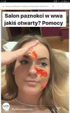 Kolejna influencerka poważnym problemem