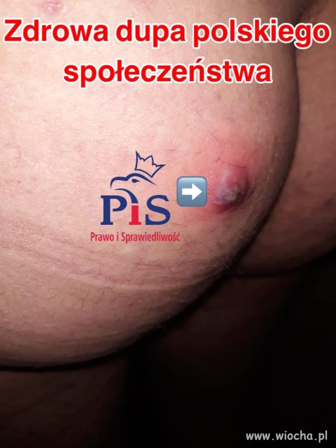 Taka ohydna prawda