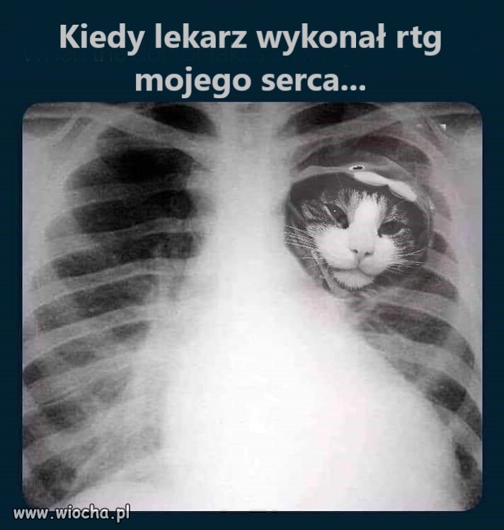 Kiedy lekarz wykonał prześwietlenie mojego serca