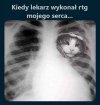 Kiedy lekarz wykonał prześwietlenie mojego serca