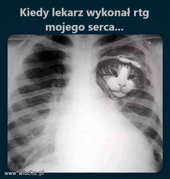 Kiedy lekarz wykonał prześwietlenie mojego serca