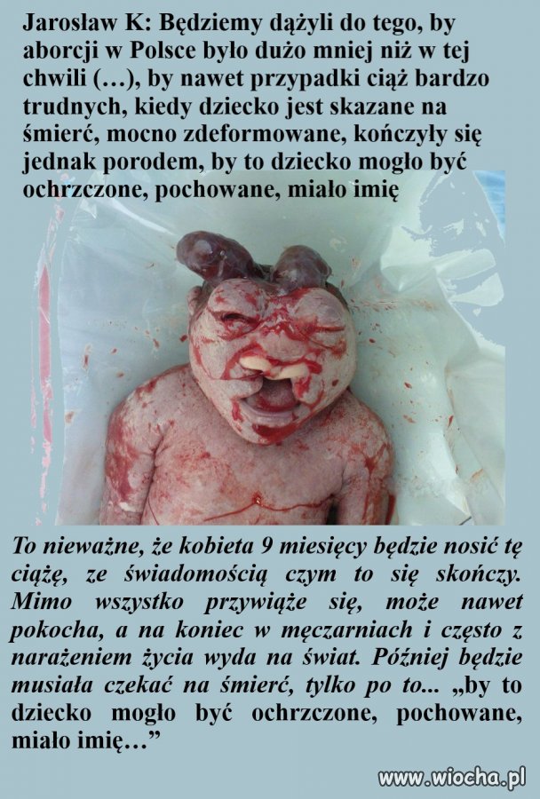 By mogło być ochrzczone, pochowane, miało imię...