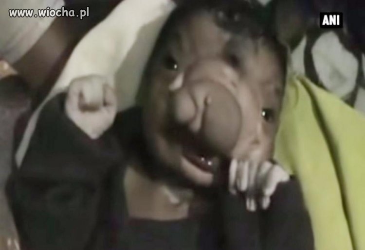 Deformacje utrudniają jej oddychanie i jedzenie