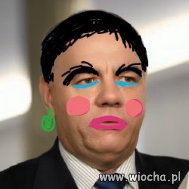 Jacek po pierwszym zabiegu za 10 tys.