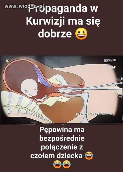 Takie rzeczy tylko w TVP