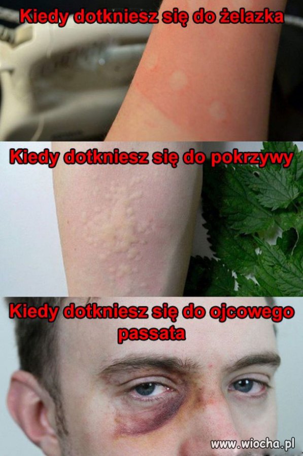 Nie dotykaj, bo się sparzysz 