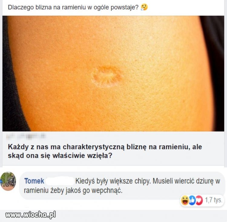 Blizna