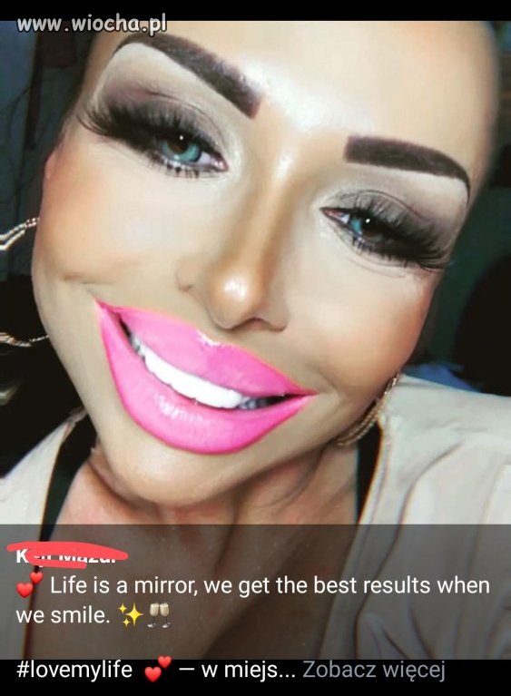 Miss smile