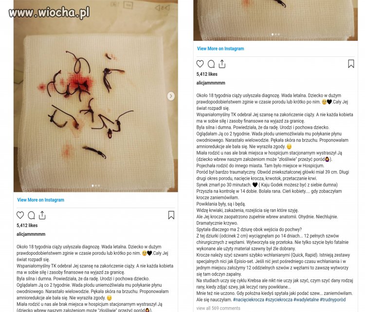 Prawo Godek masakruje kobiety