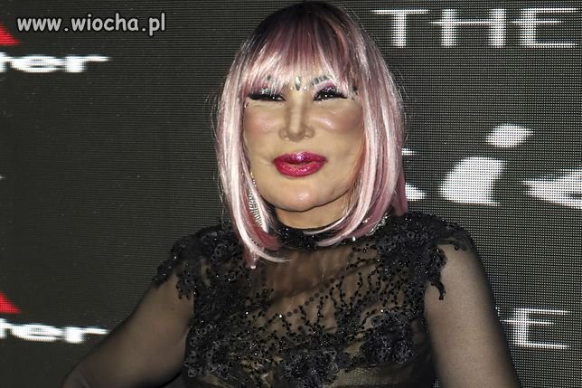 Ofiara nieudanych operacji plastycznych Lyn May