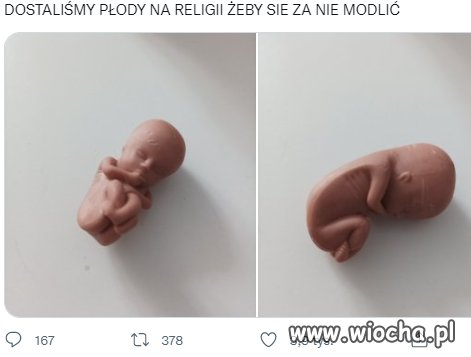 Wszyscy mamy płody,mam i Ja.