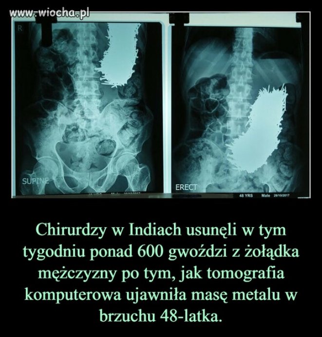 A może koleś to niespełniony fakir