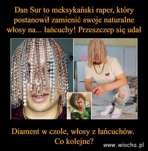 Przeszczepił sobie łańcuchy