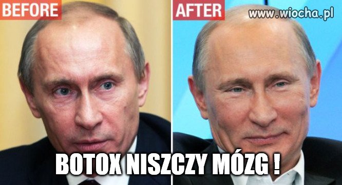 Botox zabija komórki mózgowe