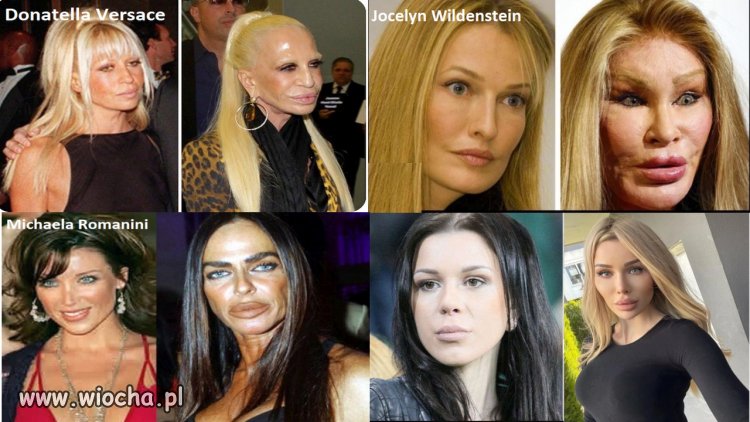 Ach te światowe trendy, kto wybrzydza nie...