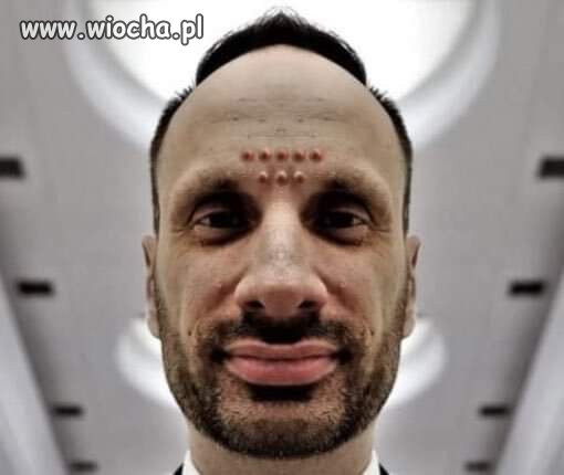 Janusz po zabiegu 