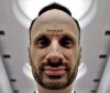 Janusz po zabiegu 