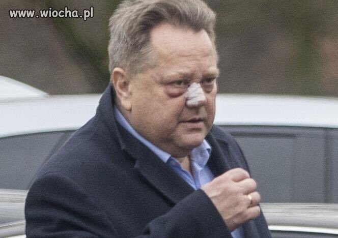 Co tu sie odkleiło
