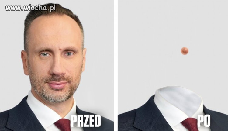 Janusz po usunięciu brodawki