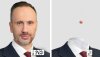 Janusz po usunięciu brodawki