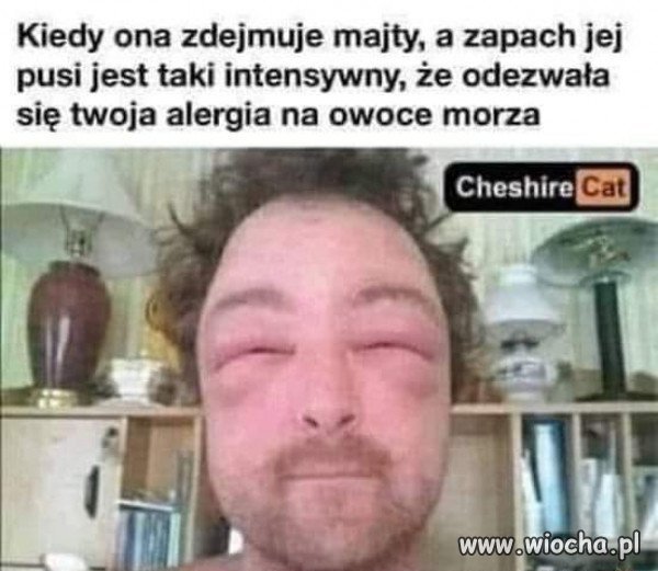 Alergia na małże.