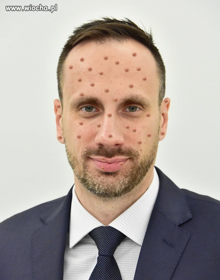 Janusz już po zabiegu