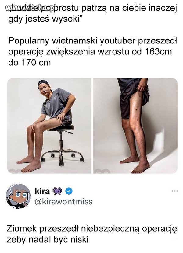 Hehe głupota chyba raczej boli 