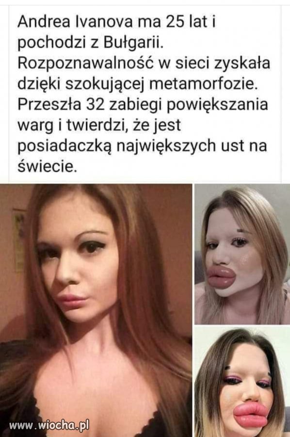 Glonojad