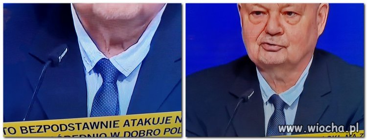 Glapa coś mizernie wygląda