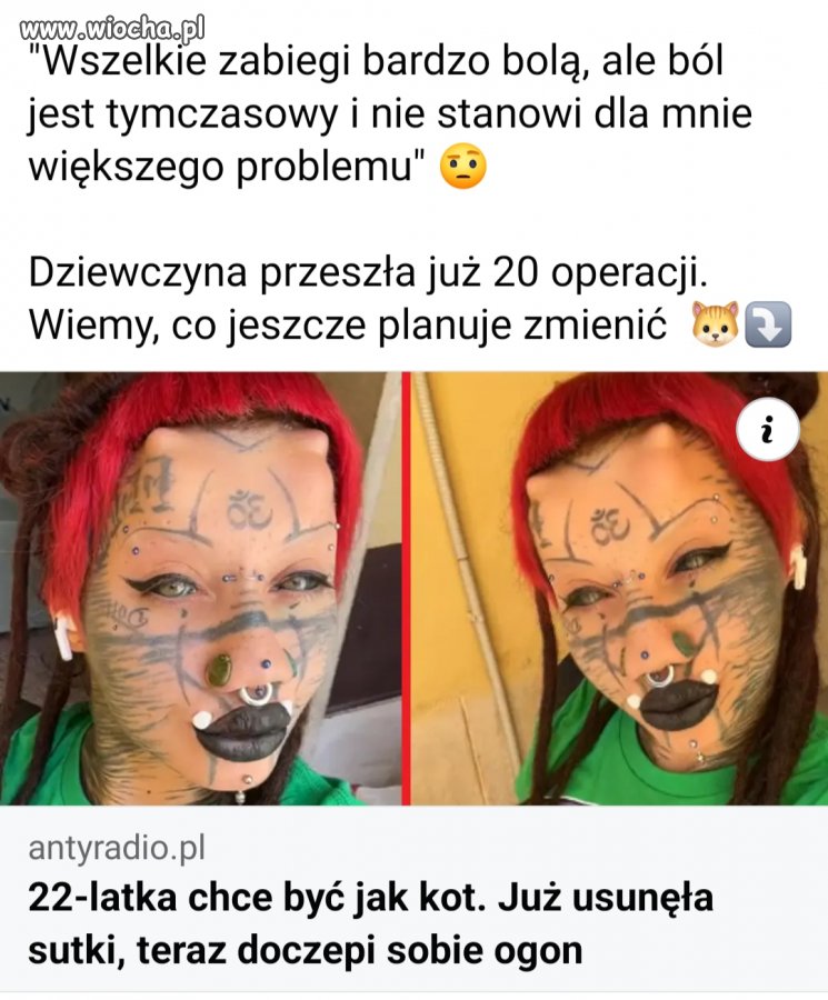 Kiedyś takie odchyły się leczyło 