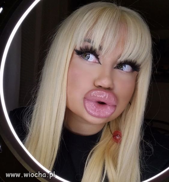 Besos XXL