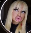 Besos XXL