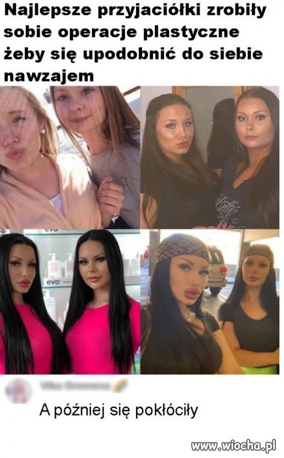 Laski to mają ciekawe pomysły