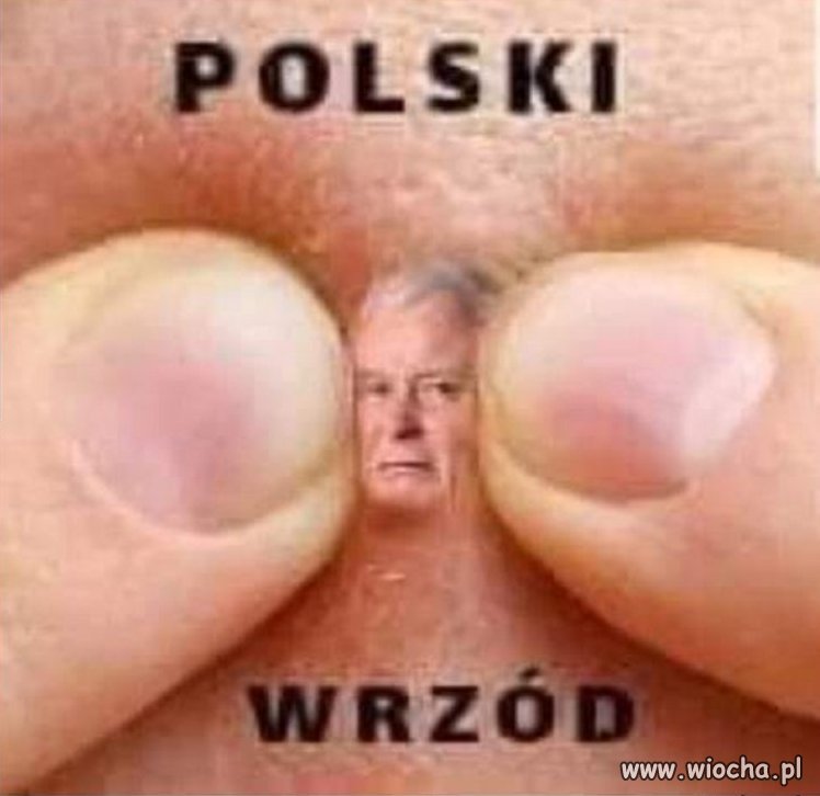 Do usunięcia