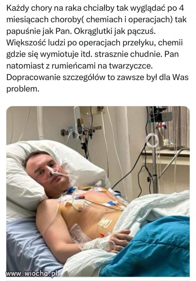Brwi i włosy po 3 chemiach ? 🤔