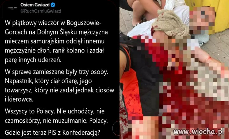Nie można porównywać niewinnego odcięcia dłoni 