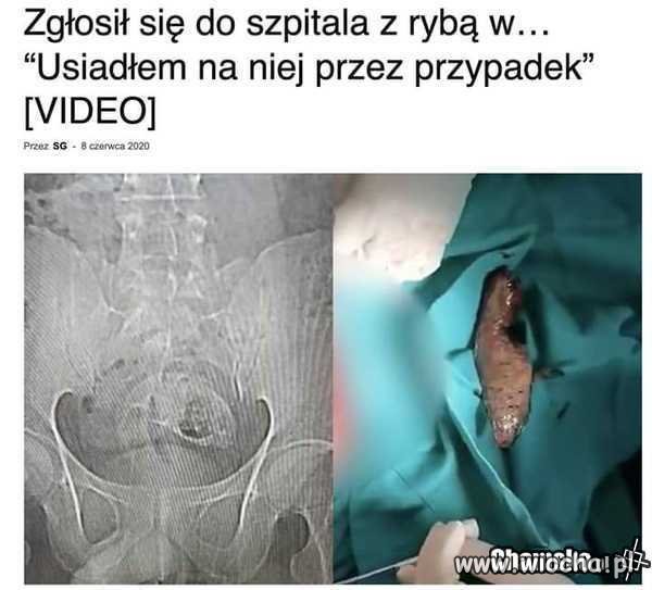 Przypadek. 
