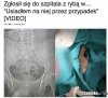 Przypadek. 