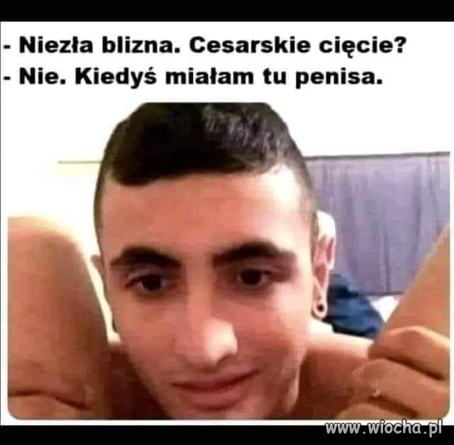Cesarskie cięcie?