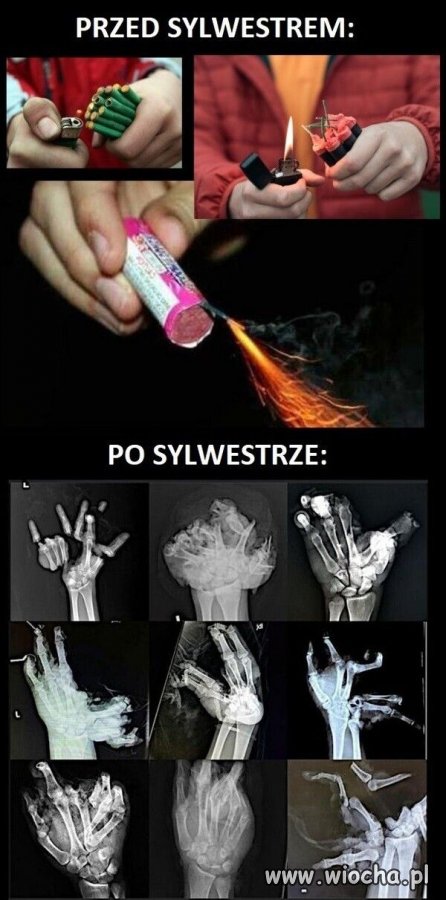 Przed i po Sylwesterze.