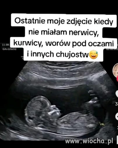 Tak jak w przypadku 