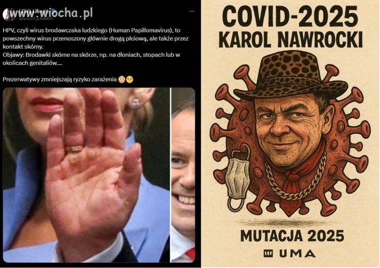 I tą rękę podawał przedwczoraj wszystkim, jak leciało