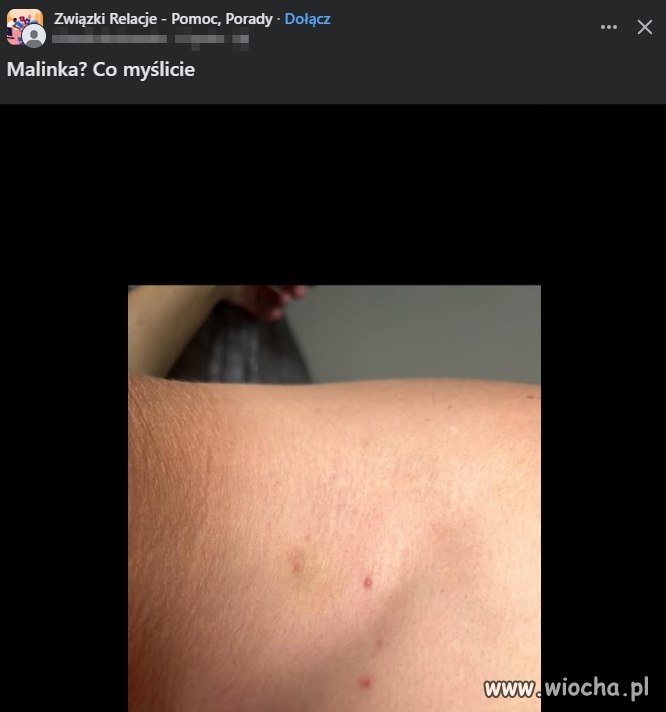 Co myślicie
